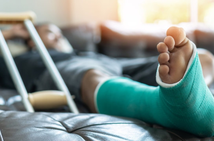 Fracture Management---------20