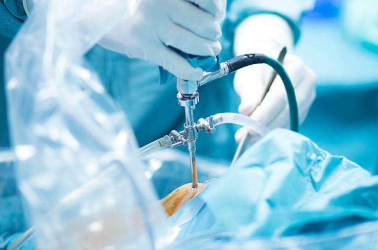 Minimally Invasive Orthopaedic Surgery--------20
